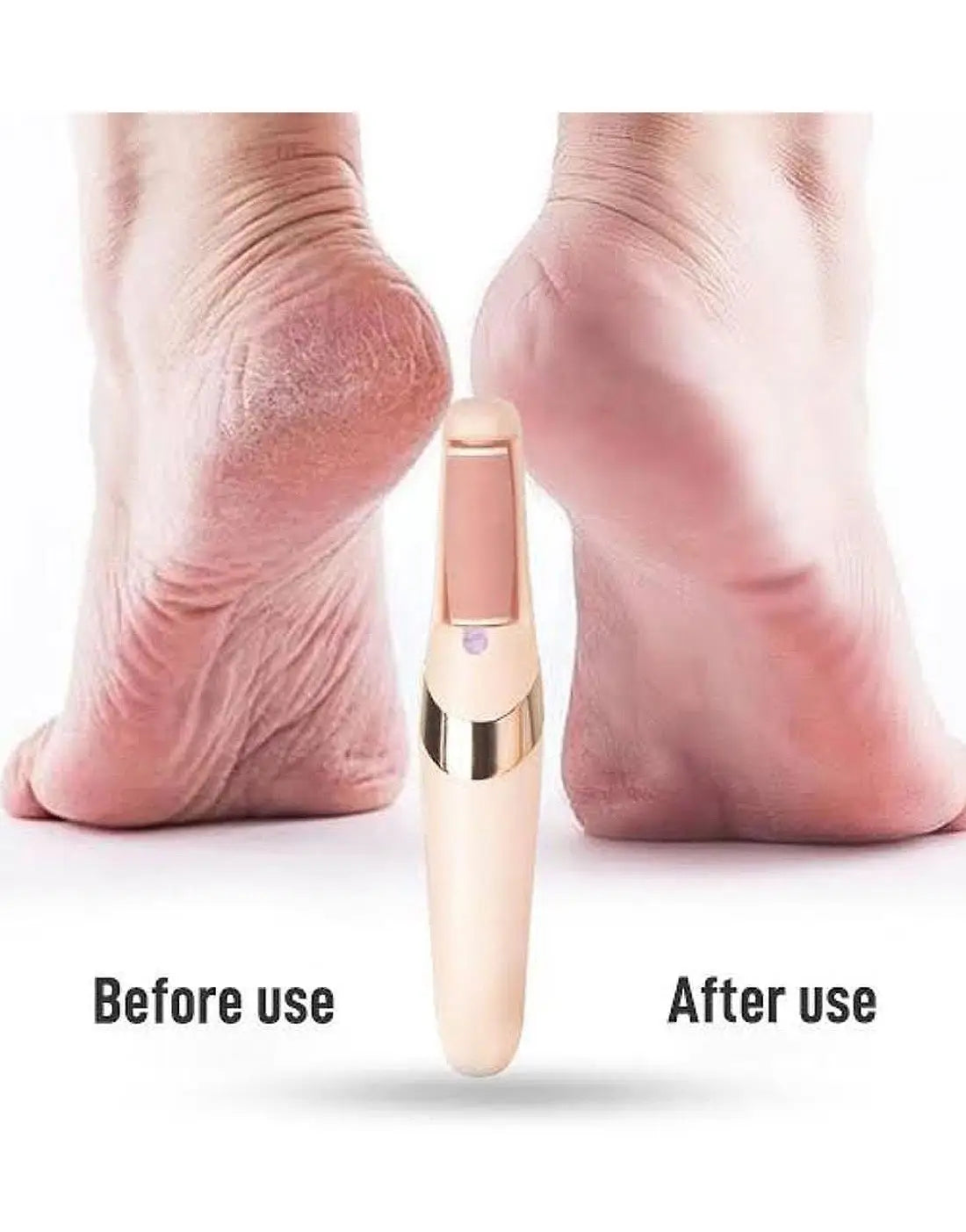 Rechargeable Electric Pedi Foot Filer Effective Callus Remover